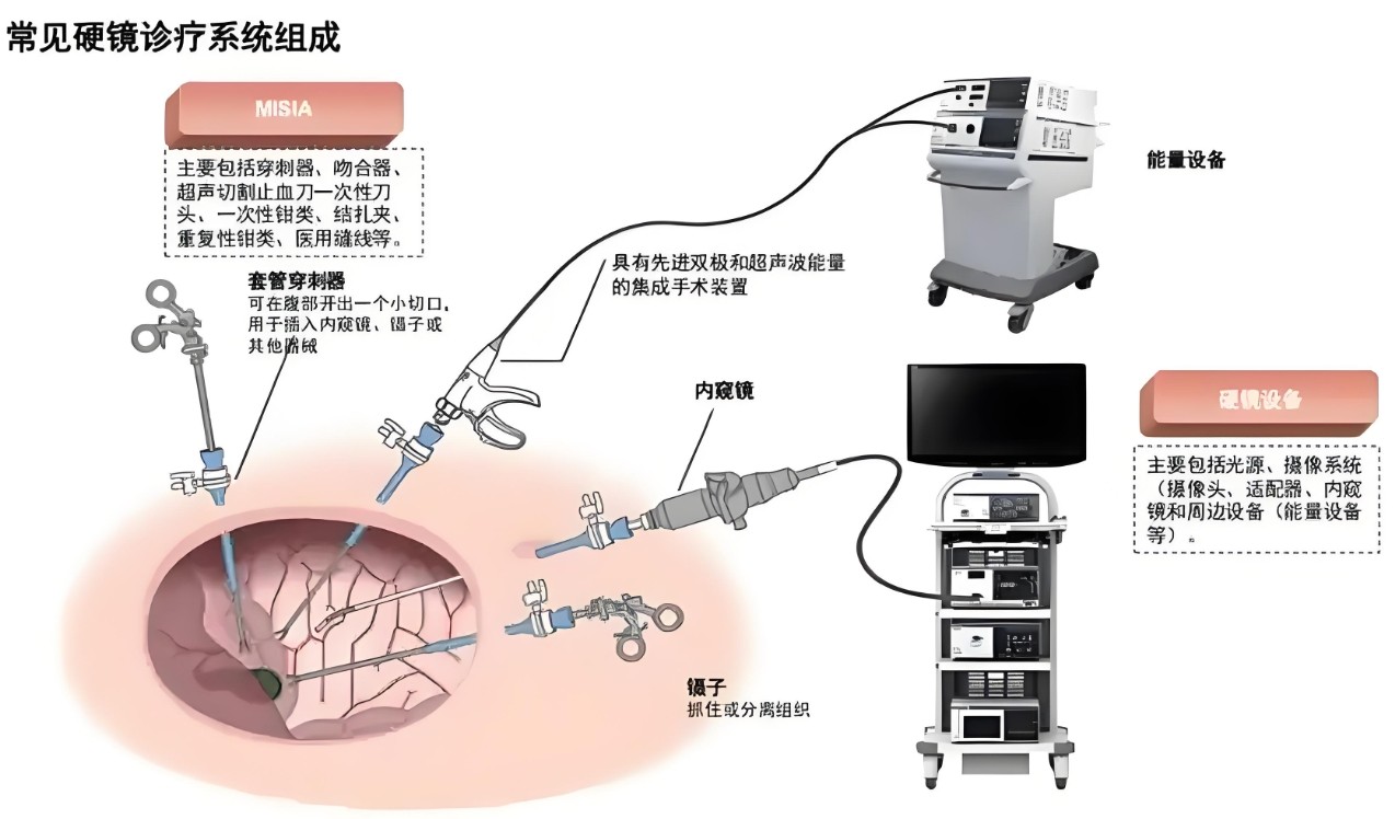 常見硬鏡診療系統(tǒng)組成