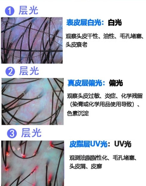 不同光對頭發(fā)的觀測效果