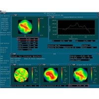 光學(xué)鏡片面形解析--從設(shè)計形狀到精度參數(shù)PV與RMS